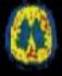 brain_s.jpg (1269 byte)